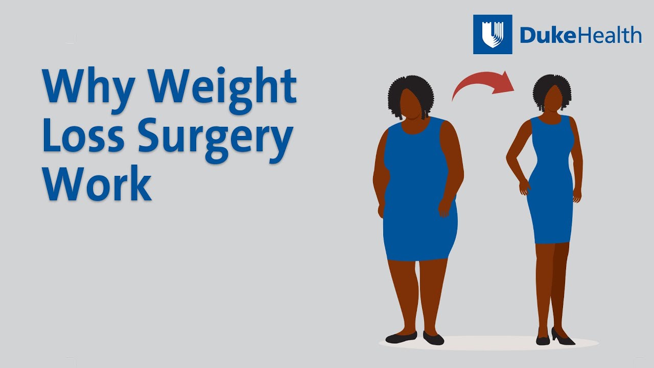 Why Weight Loss Surgery Works | Duke Health