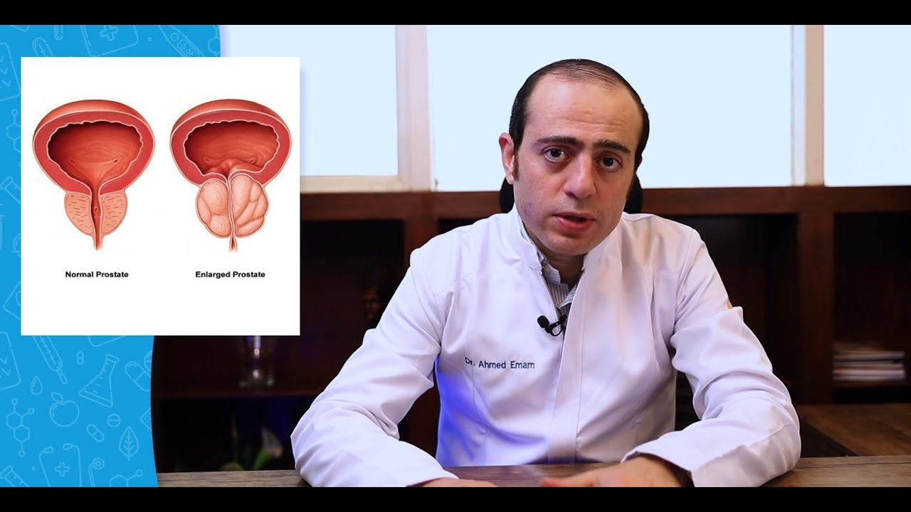 كل ما تريد معرفته عن أسباب و أعراض و علاج تضخم البروستاتا الحميد