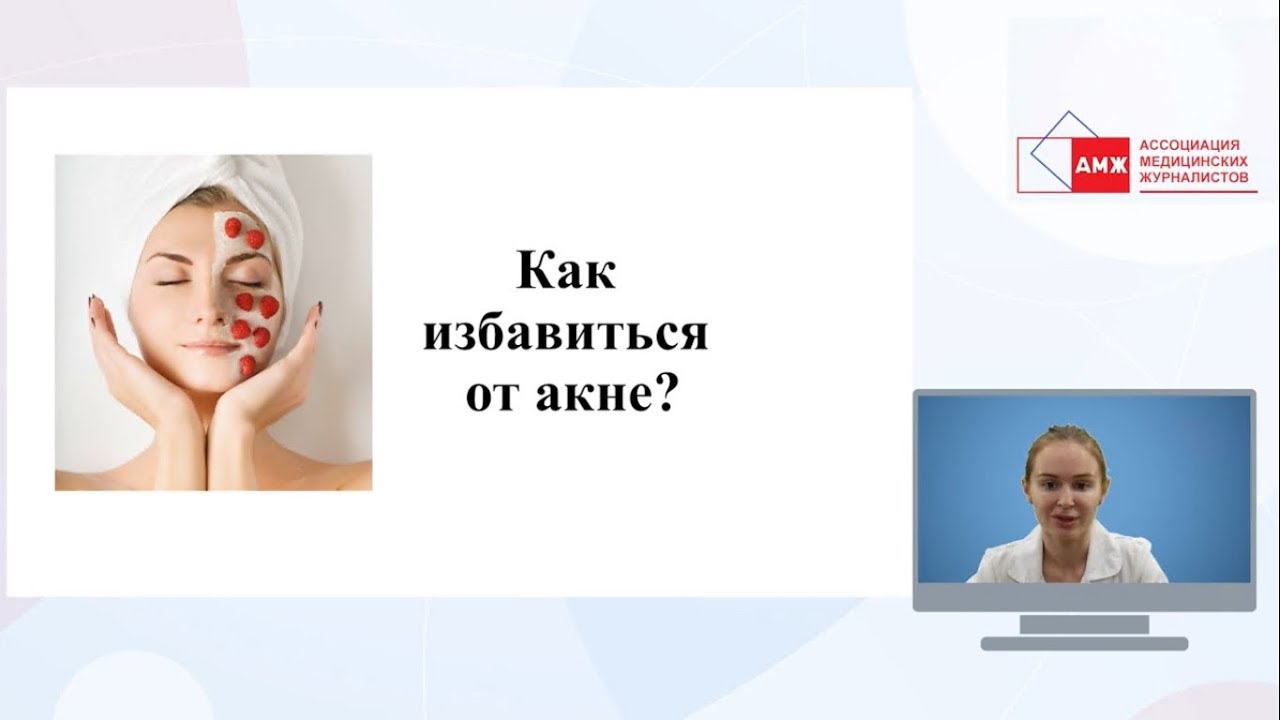 Как избавиться от акне?