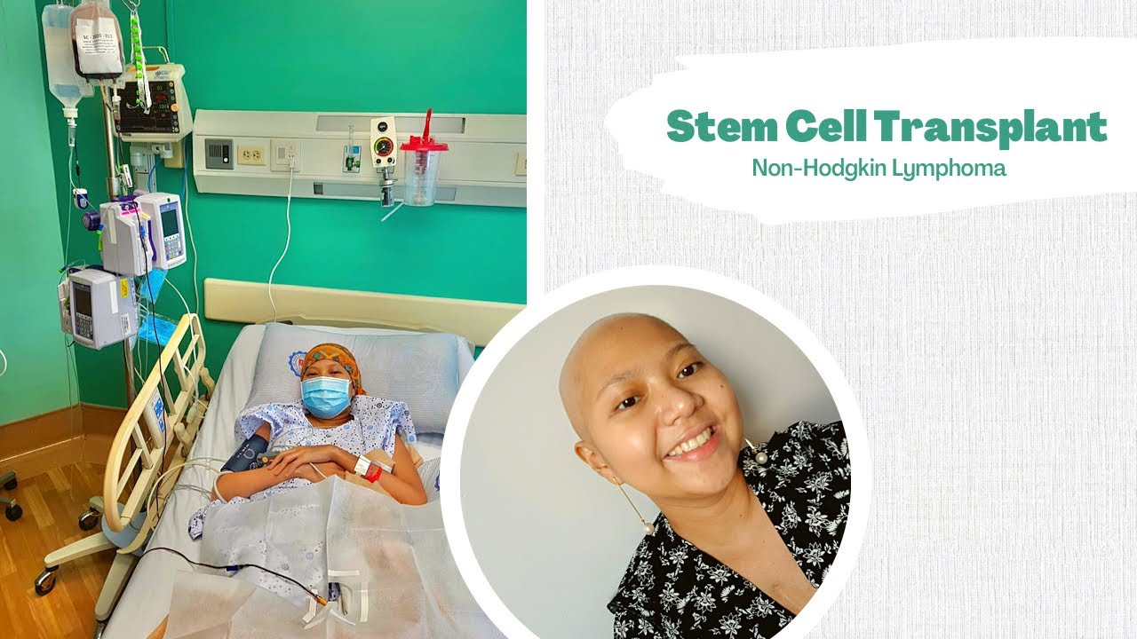 Stem Cell Transplant | Non-Hodgkin Lymphoma