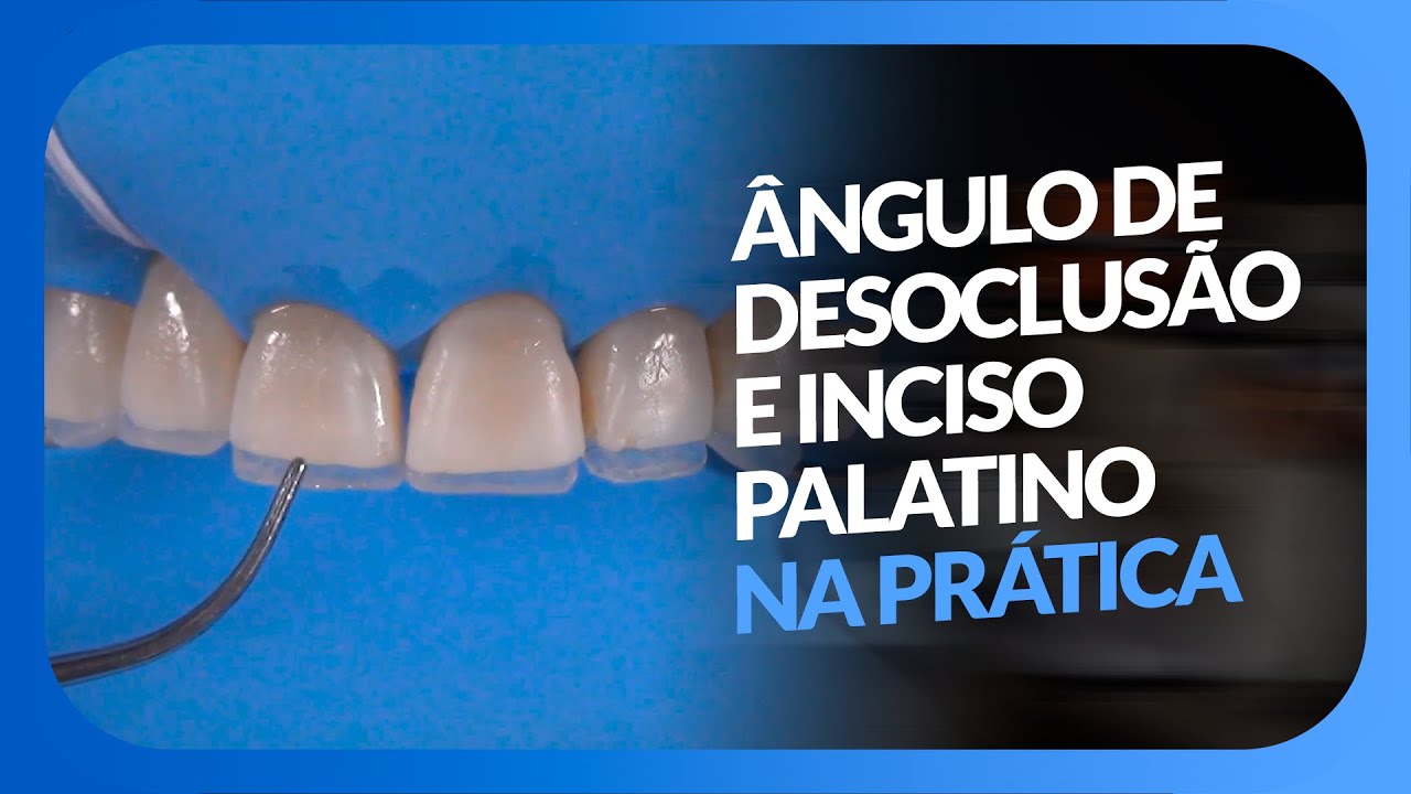 CONTORNO E ÂNGULO