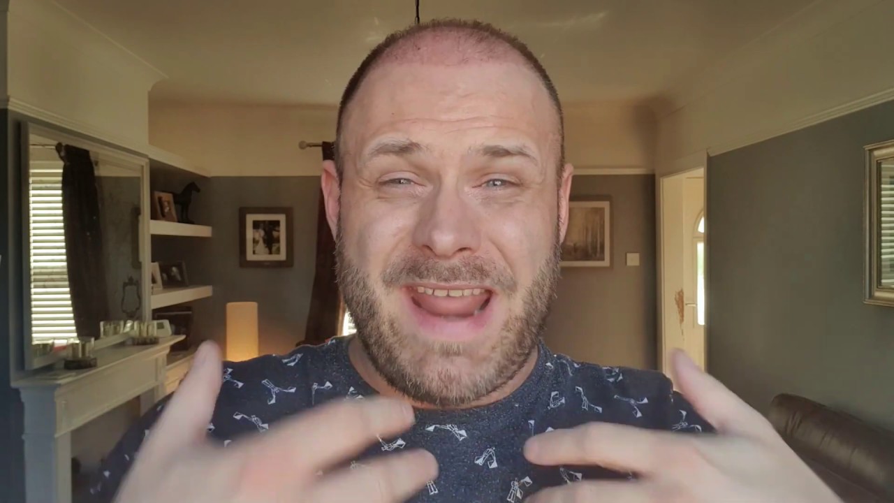 WEEK 7-ish of my Hair Transplant Istanbul Journey with Dr Balwi and Elithairtransplant