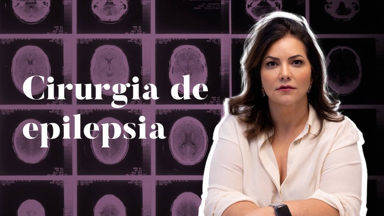 Cirurgia de epilepsia: quando é indicada? | Isabella D'Andrea