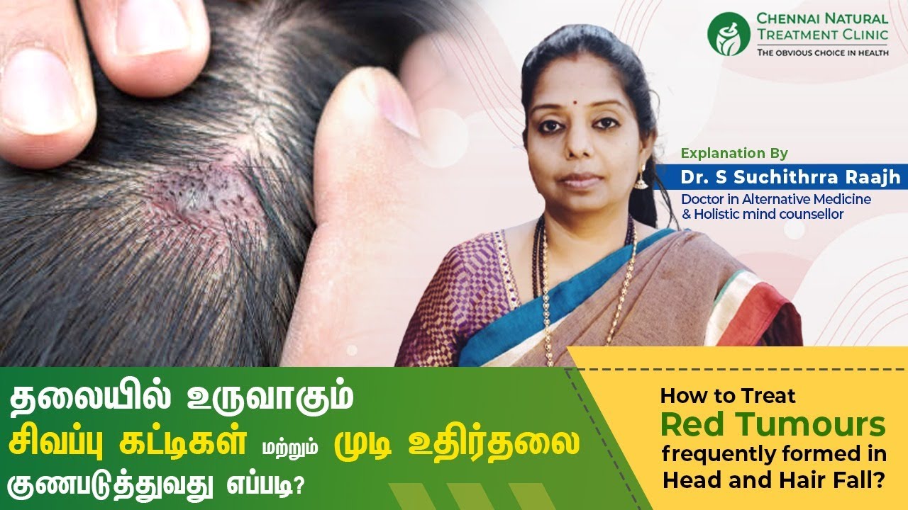 தலையில் சிவப்பு கட்டிகள் முடி உதிர்தலை குணபடுத்துவது எப்படி | Red Tumors formed in Head & Hair Fall?