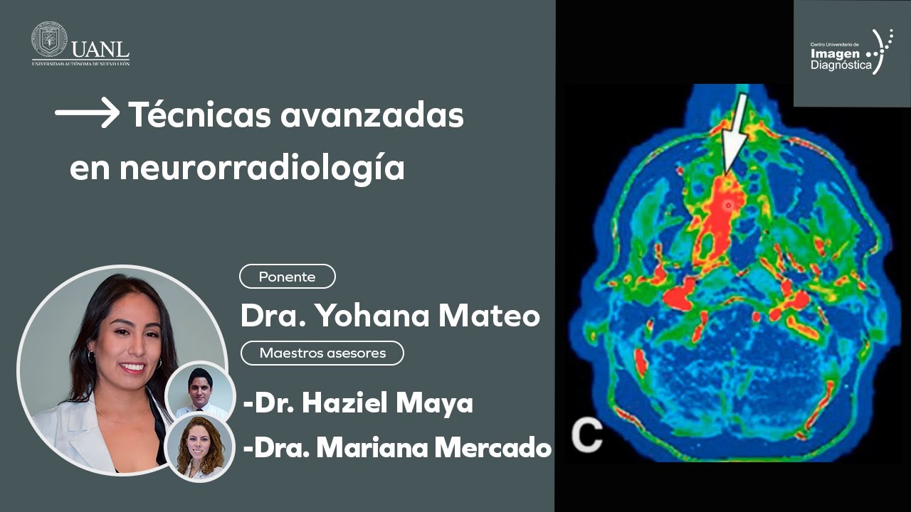 Técnicas avanzadas en neurorradiología por la Dra. Yohana Mateo