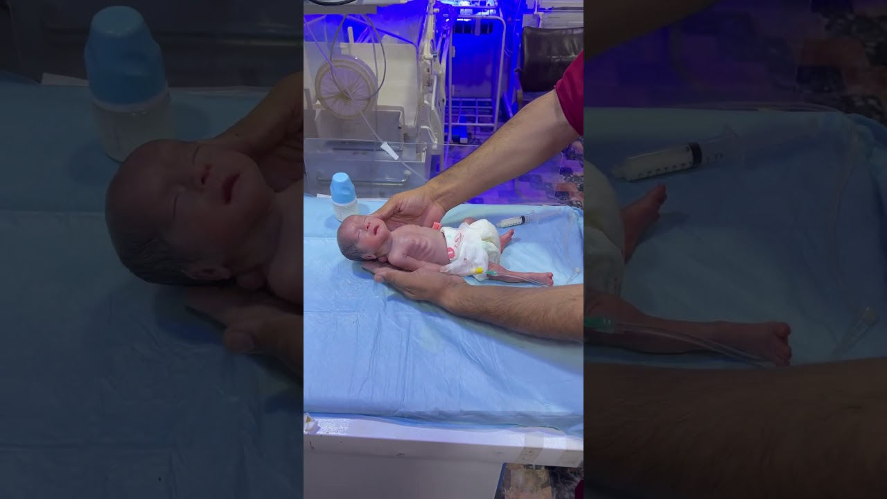 NICU Baby Physiotherapy After Feeding | Premature Baby Care #amnioticfluid #baby