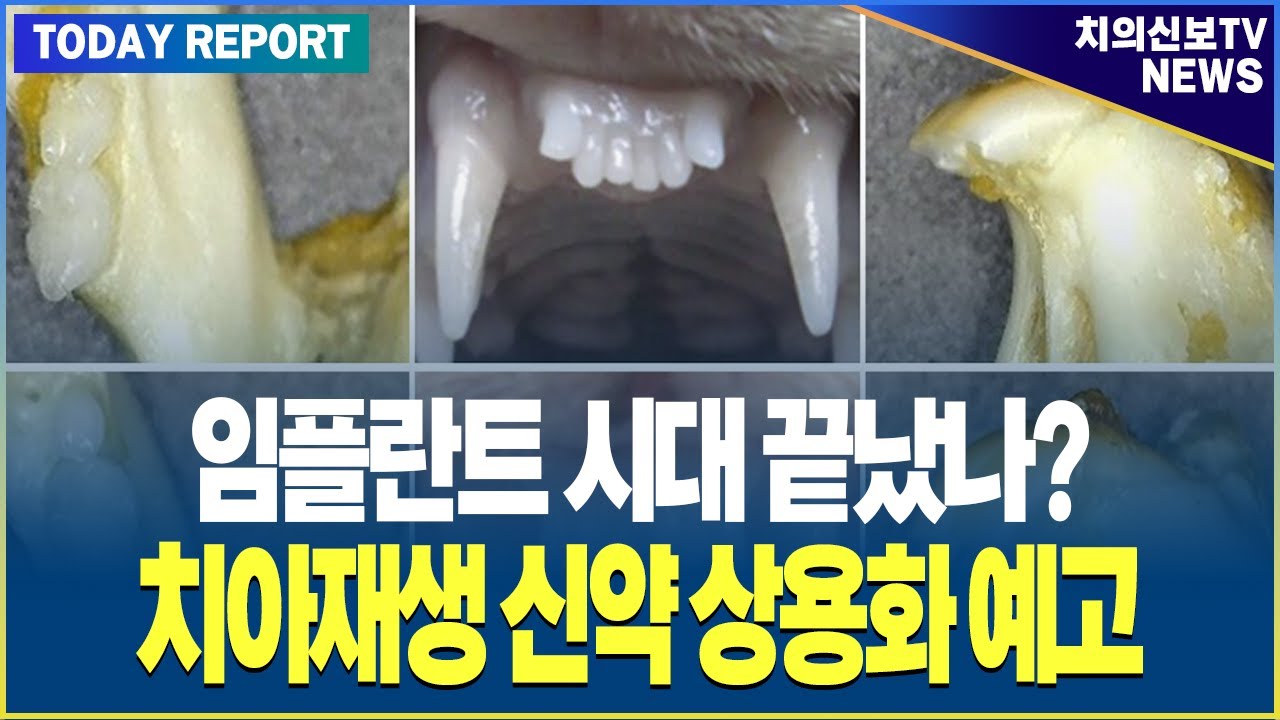 치아재생이 가능하다고?