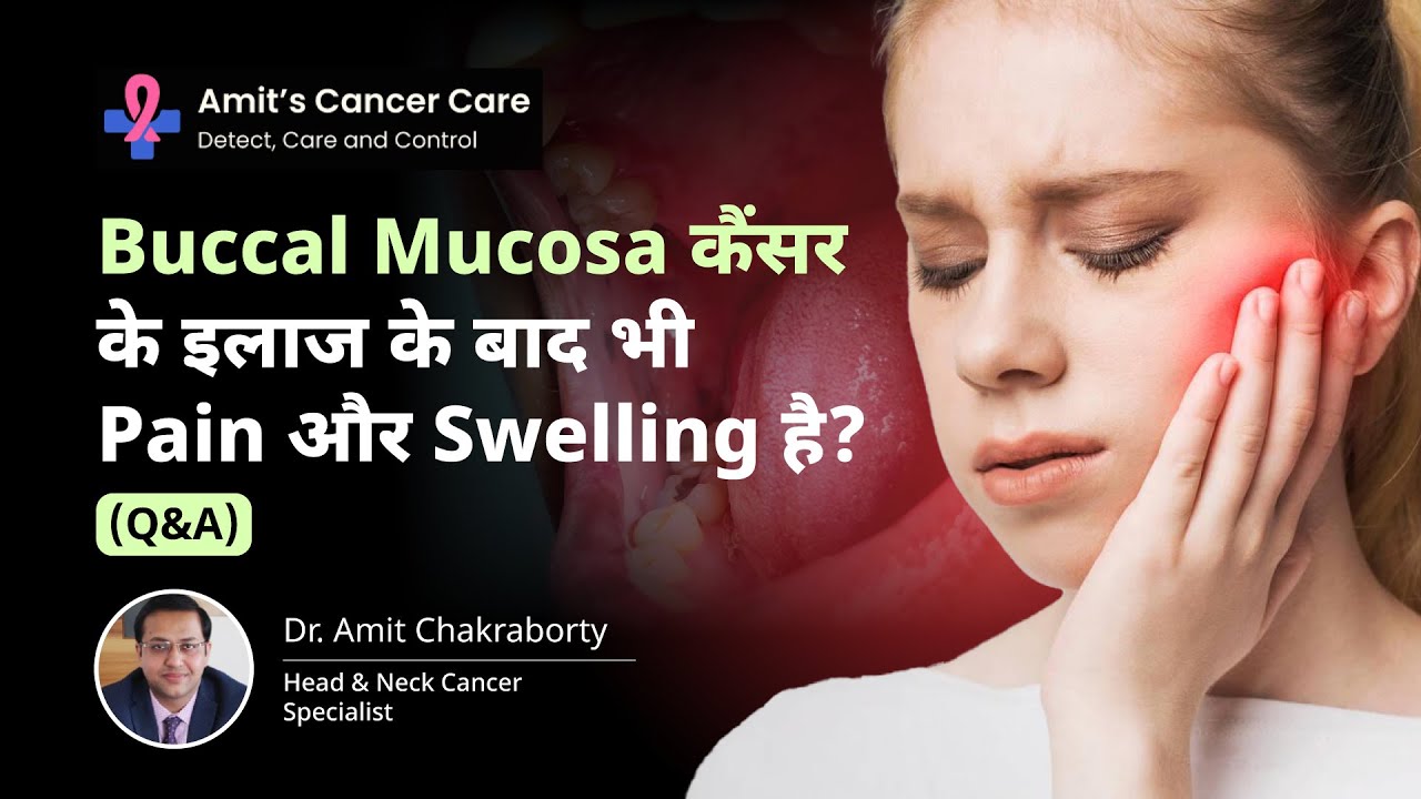 Buccal mucosa कैंसर के इलाज के बाद भी Pain और Swelling है? | Cancer Q&A | Dr Amit Chakraborty