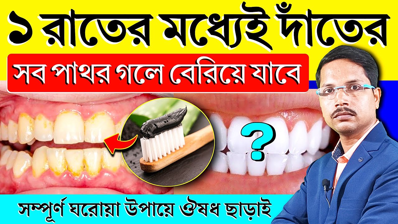 ১ রাতেই দাঁতের পাথর গলে বেরিয়ে যাবে - কালো হলুদ দাগ উঠে যাবে ✅ Teeth Cleaning at Home.
