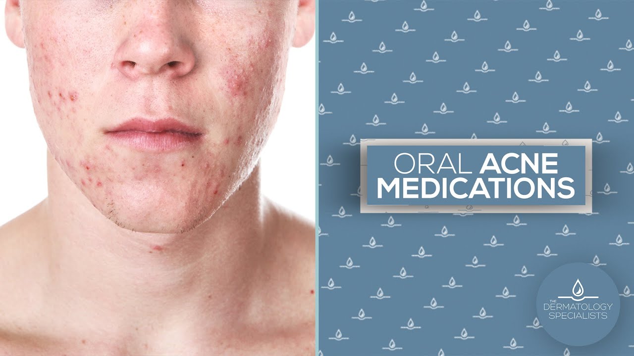 Oral Acne Medications