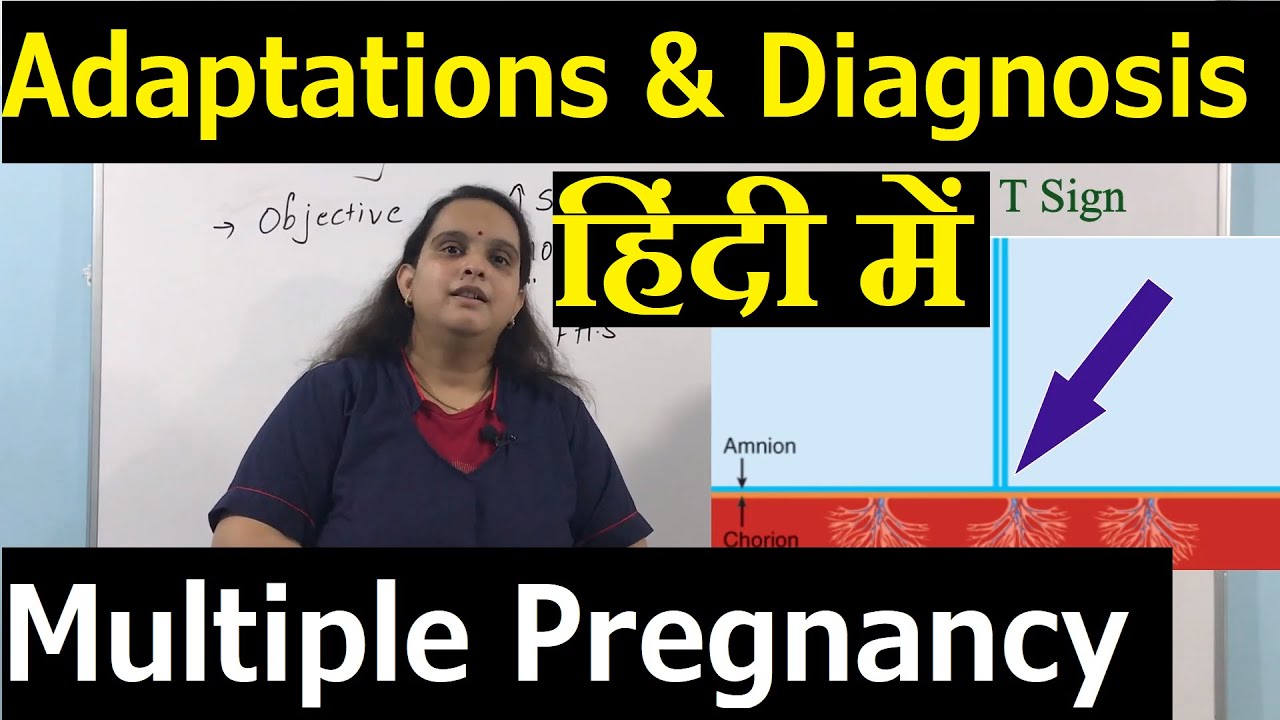 Multiple Pregnancy Maternal Adaptations & Diagnosis in Hindi | Nursing Lecture