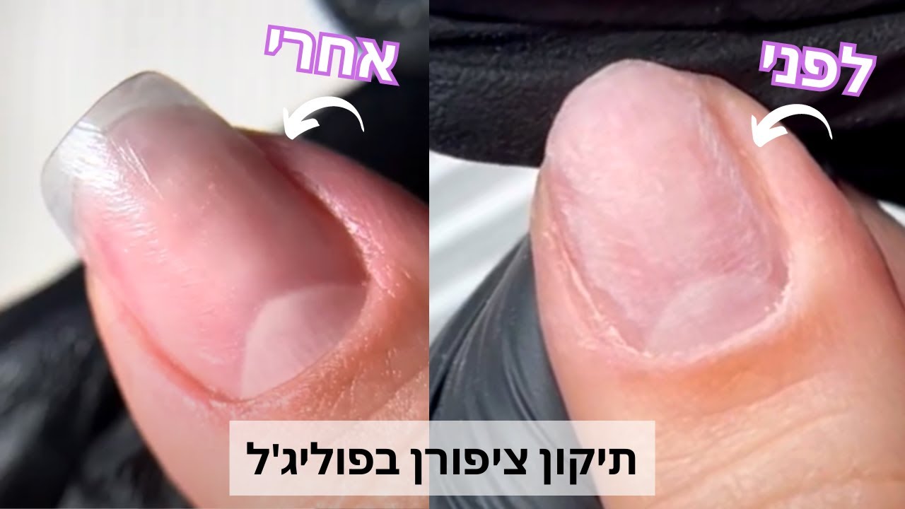 איך לתקן ציפורן שבורה עם פוליג&rsquo;ל - חזק ובמראה טבעי