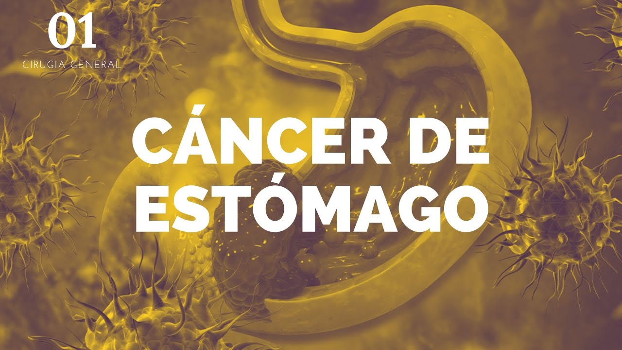 Cáncer de estómago - ENARM