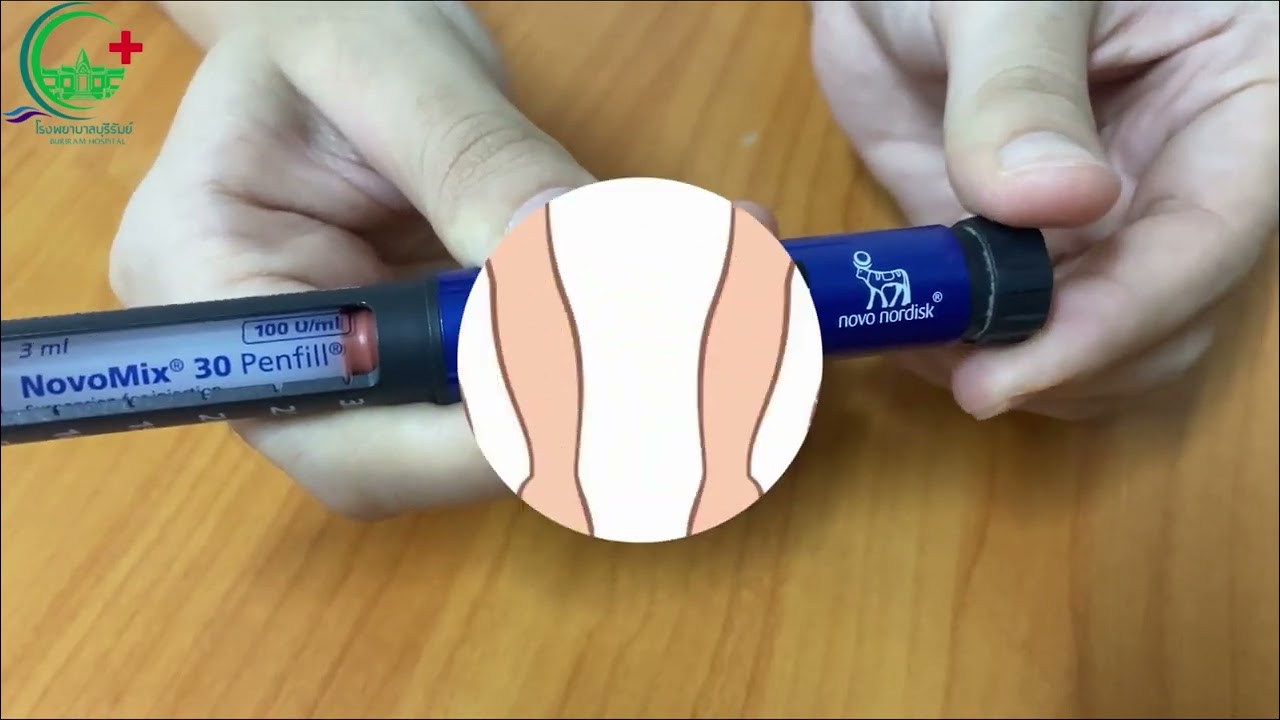 ตัวอย่างและขั้นตอนการใช้ปากกาอินซูลิน Novopen 4