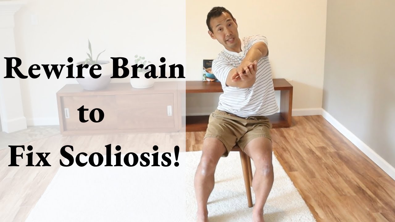 How to Fix Your Scoliosis Permanently: A Brain and Movement Retraining Guide 1