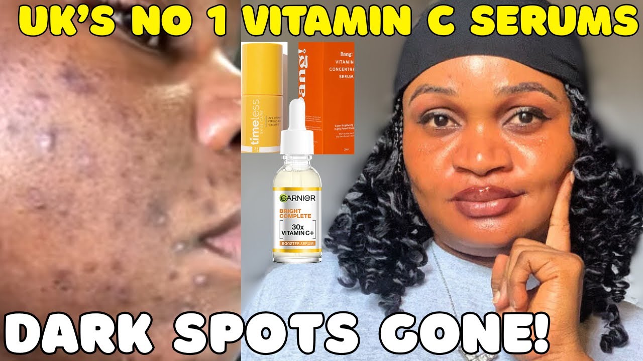5 ЛУЧШИХ сывороток с витамином С в Великобритании, которые быстро осветляют темные пятна и улучша...