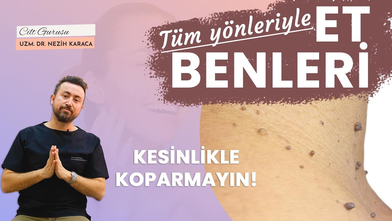Et Benleri Hakkında Herşey