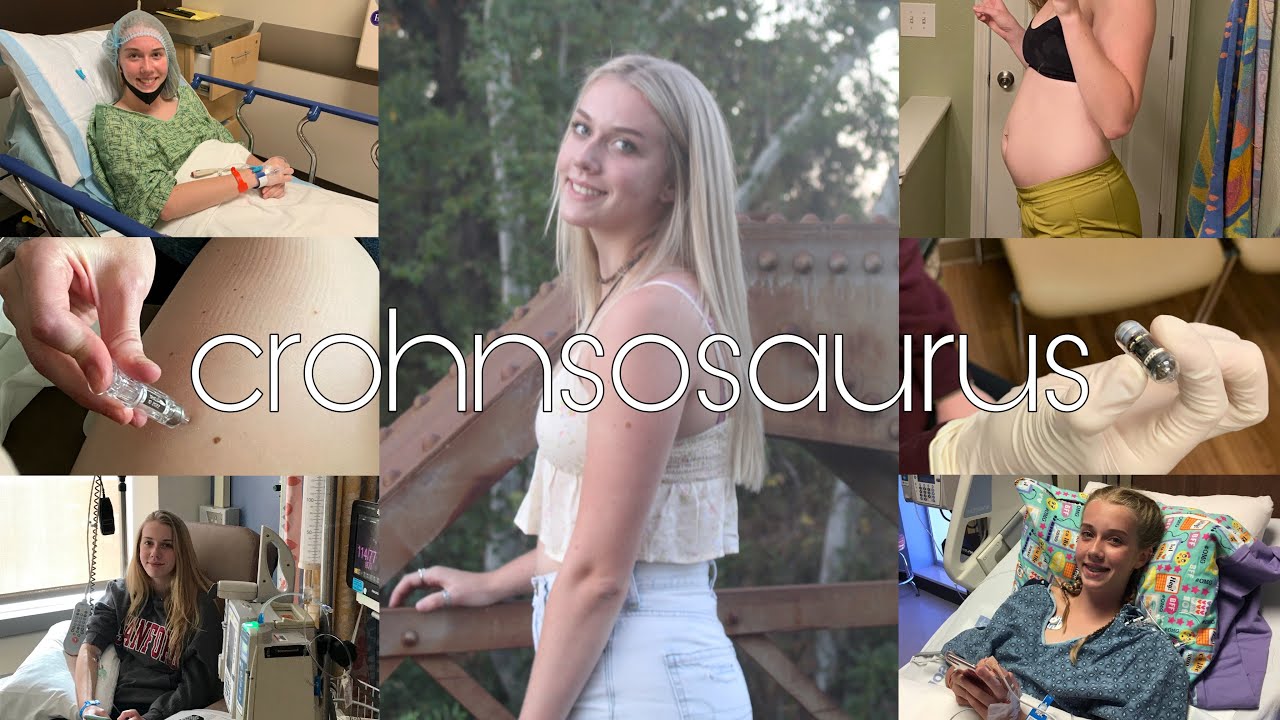 My Chronic Illness Story || IBD and CSID