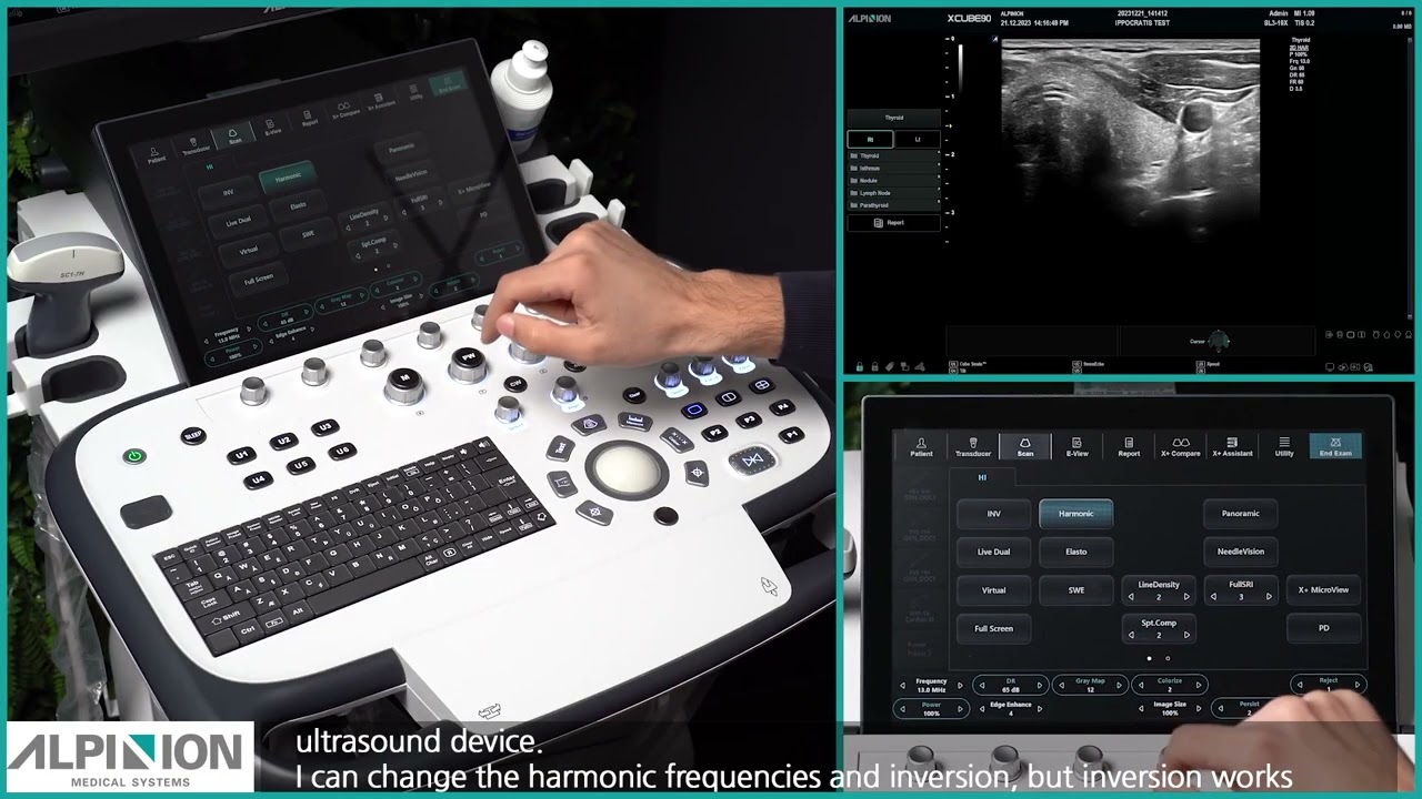 X-CUBE 90 Tutorial: THYROID EXAMINATION