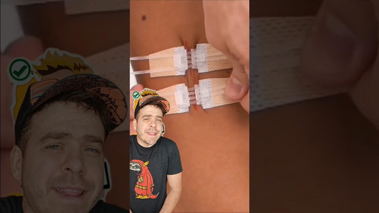 prob&eacute; este invento para cuando te cortas o te haces una herida  pongamoslo a prueba