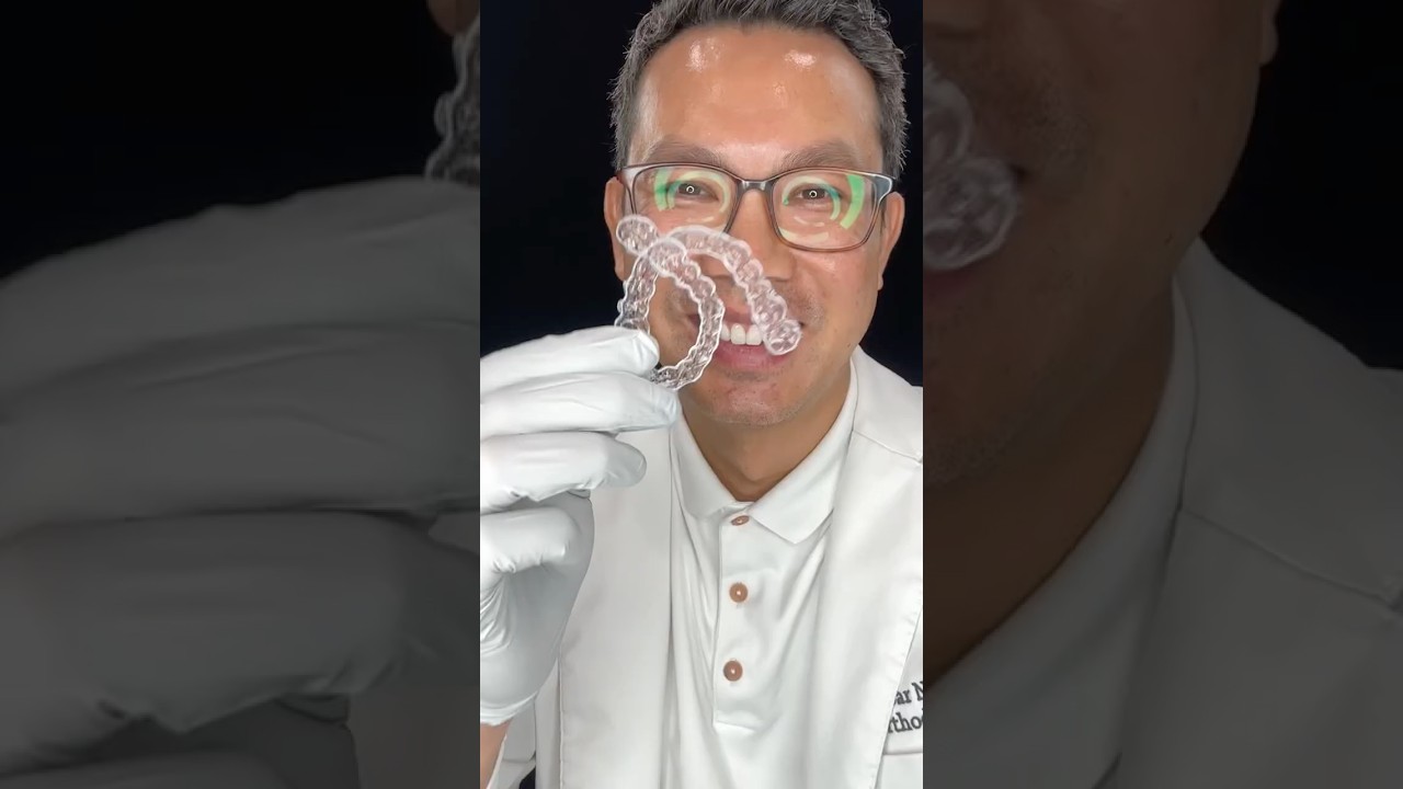 How Clear Aligner Attachments are put on