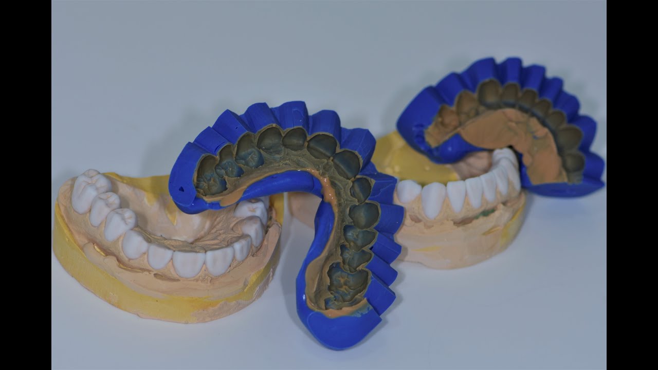 Silicone Index Fabrication