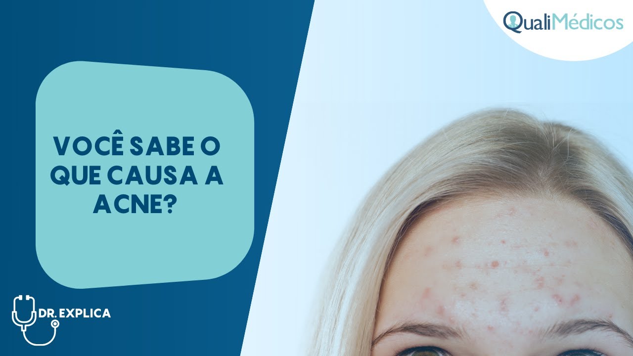 O que causa a acne? Dermatologista explica