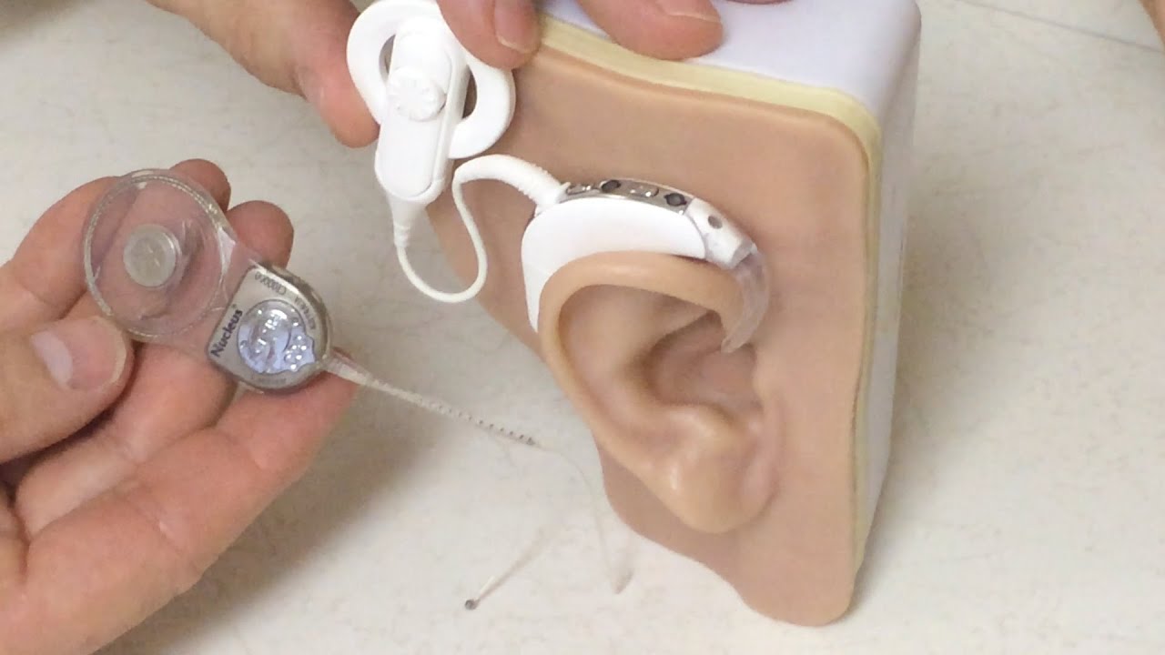Sound Science: Hybrid Cochlear Implants