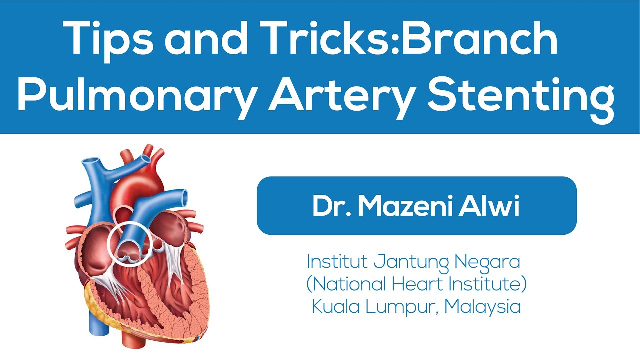 Tips and Tricks: Branch Pulmonary Artery Stenting