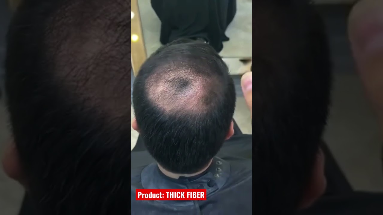 Thinning Hair Concealer ! Hair Transformation
