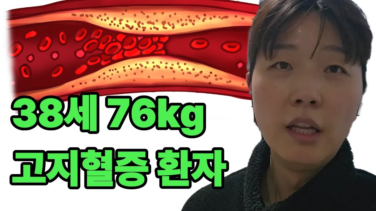 고지혈증 환자가 하면 좋은 것 다 해보기 (LDL 콜레스테롤 낮추기 0주차)