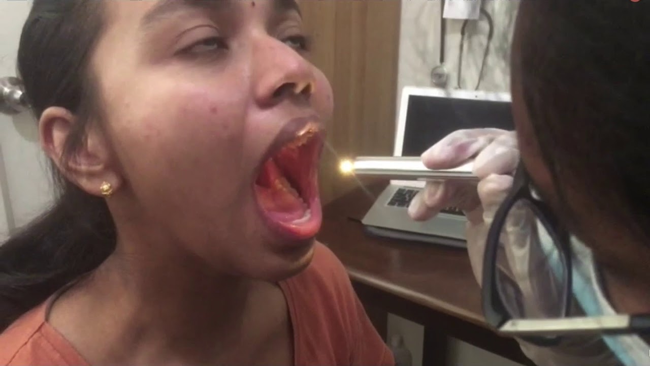 NOSE, MOUTH AND NECK EXAMINATION - INTERNAL MEDICINE