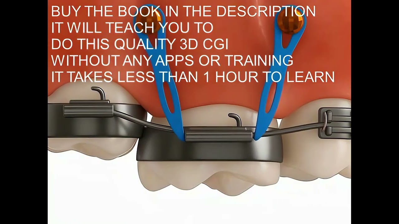 Learn to create Dental 3D animations and dental 3D content with this book in less than 1 hour!