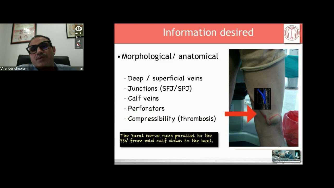 GE Webinar: Venous doppler for lower limbs by Dr. Virender K Sheorain