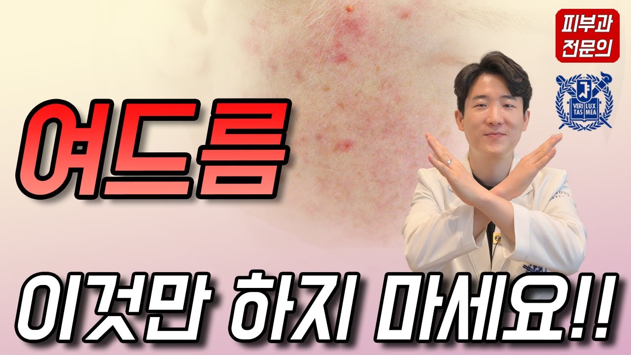 여드름 없어지는 7가지 습관!! 이렇게 하면 여드름 좋아집니다!~~ 피부과전문의 닥터피부광 /여드름없애는방법/