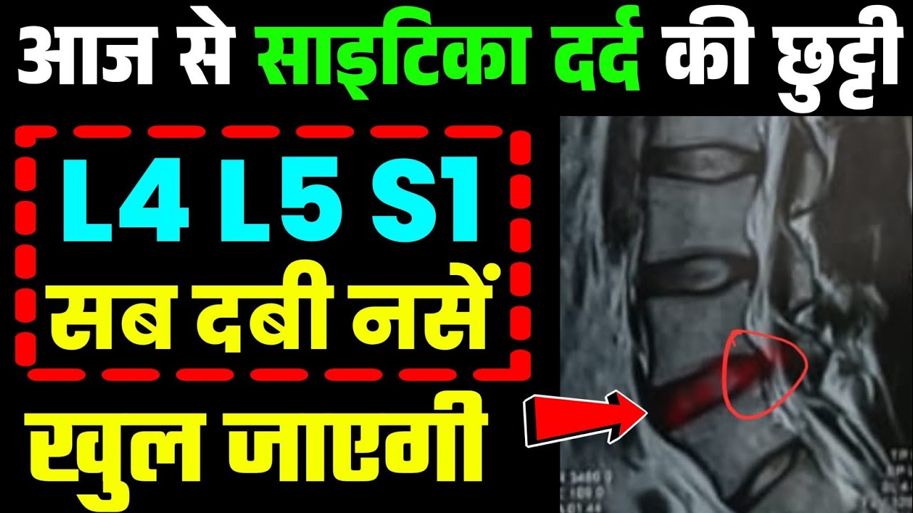 कमर की दबी नस घर पर खोलें|Exercises For Sciatica Pain Relief Exercises|Back Pain Relief Exercises