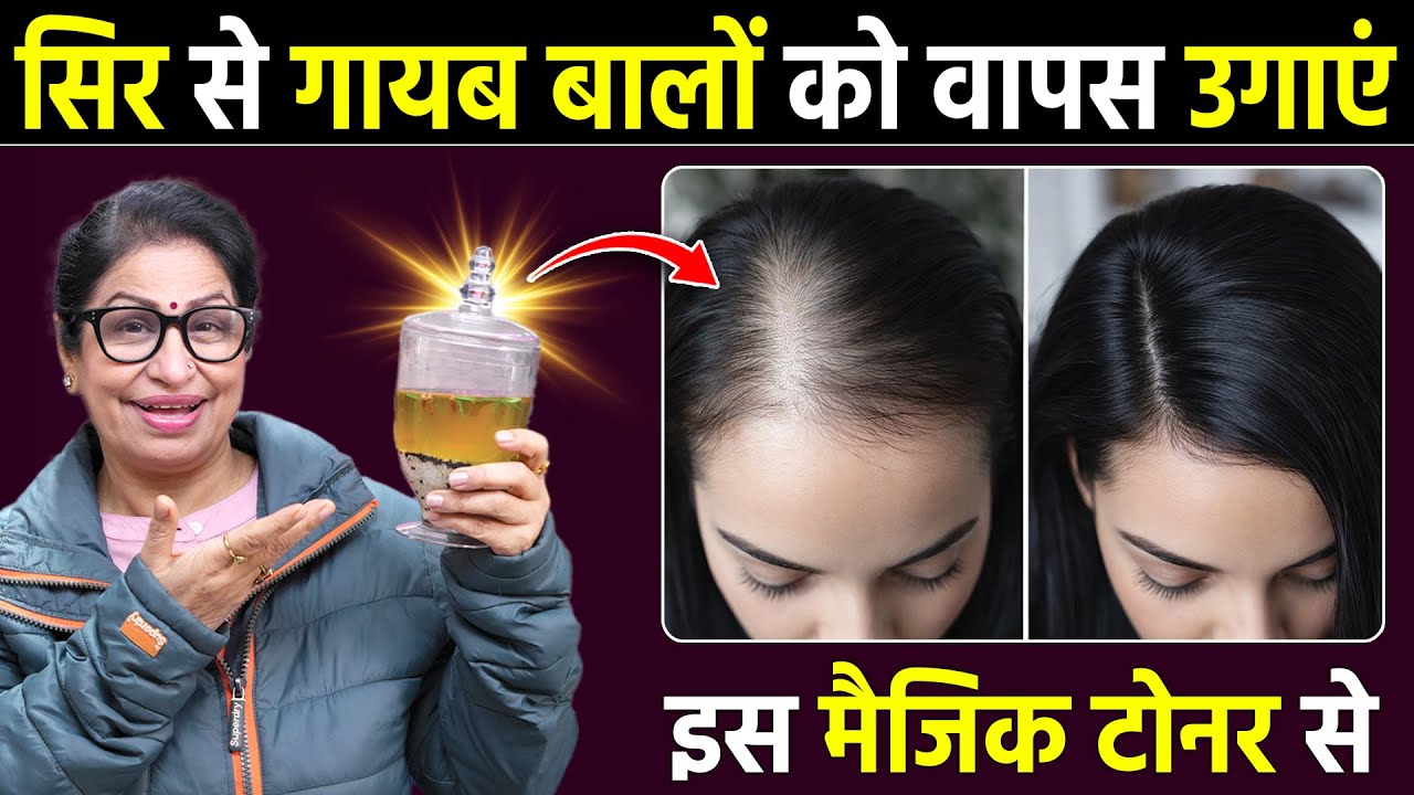 ये HAIR REGROWTH TONER लगा लो - गंजे सिर पर भी 100% नए बाल उगा देगा | DIY Fast Hair Growth Serum