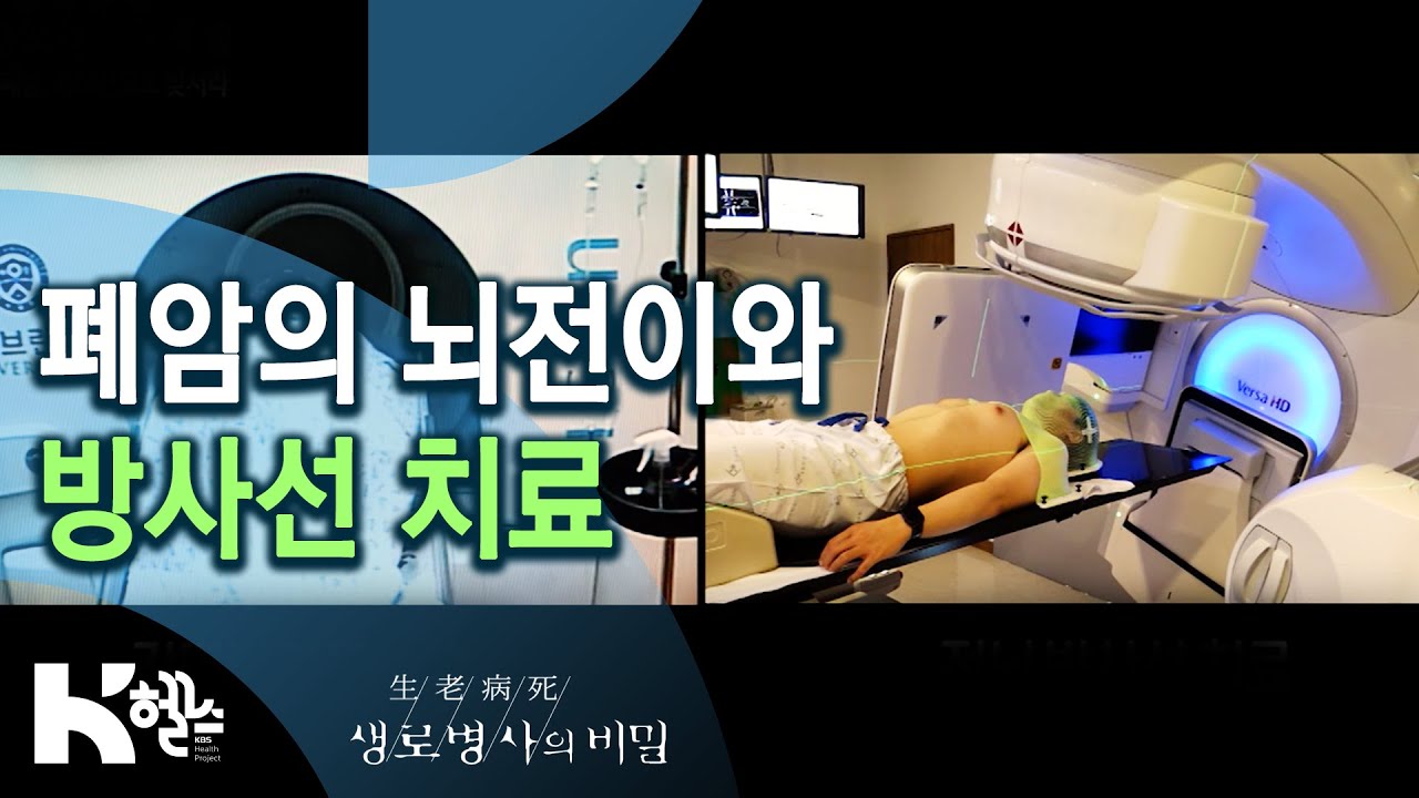 폐암의 뇌전이와 방사선 치료 - 폐암, 속도전으로 맞서라 (KBS_746회_2020.09.23)