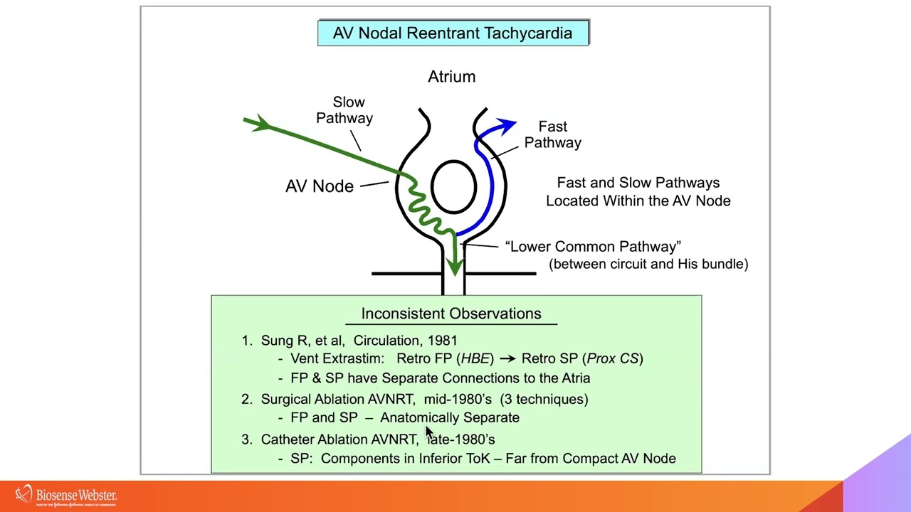Complex Cases Simplified:  AVNRT Part I with Warren 