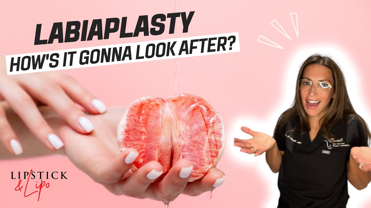 Labiaplasty: What will I look like after?
