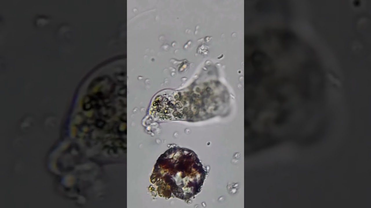 Spend 5 minutes with an Amoeba! 