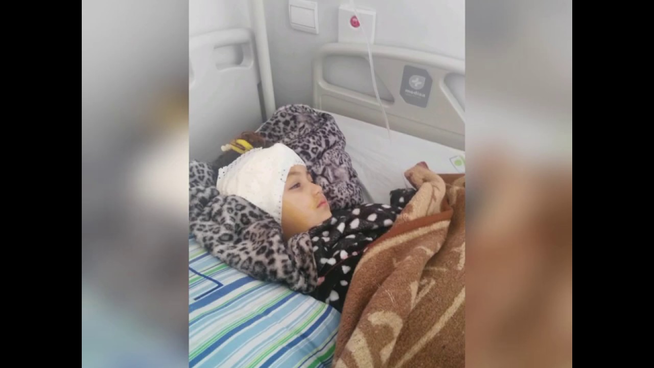 لحظة سماع إيمان للصوت أول مرة بعد زراعة القوقعة