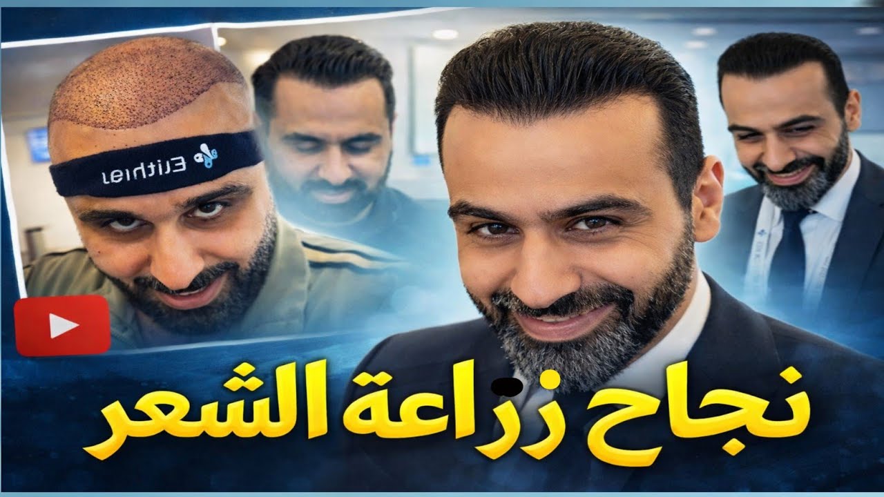 خليل البلوشي بعد أول يوم عملية زراعة الشعر 
