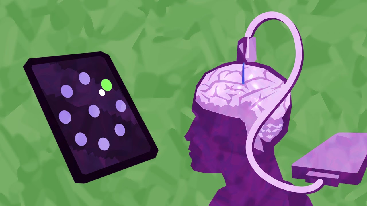 Question Your World - When will Communications Technology be Implanted in Humans?