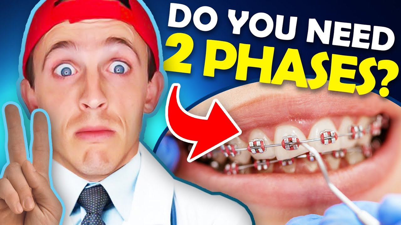 Do you need two phases of orthodontics treatment? Watch BEFORE your visit the Orthodontist