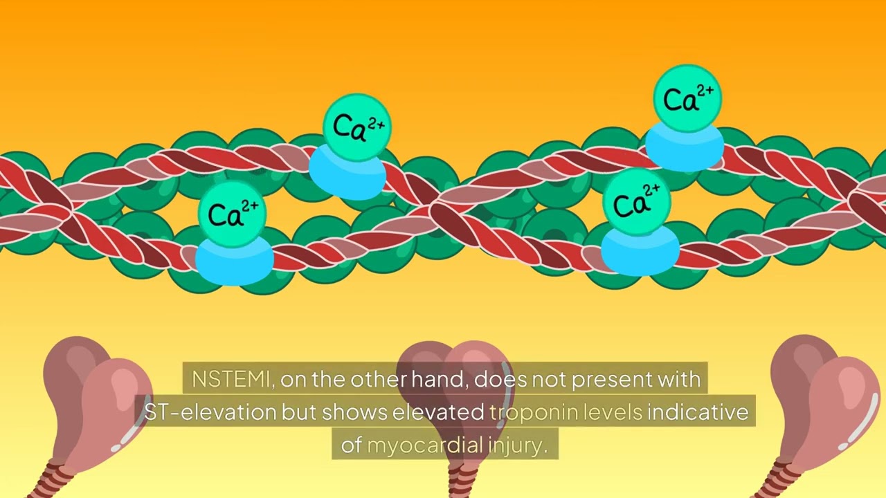 Medical Specialists Associates - Using Troponin to Screen for STEMI and NSTEMI