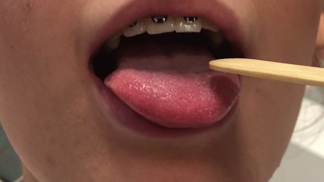 Práctica Exploración cavidad oral