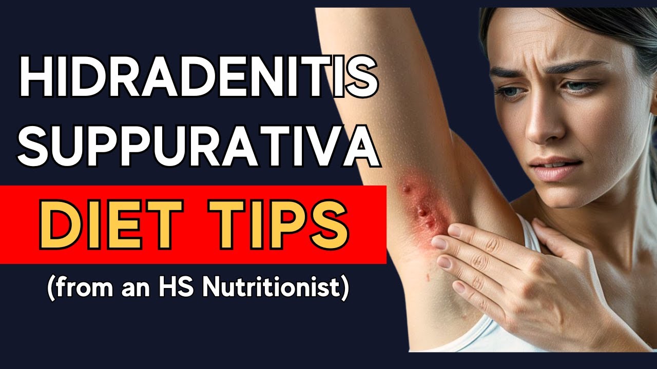 Hidradenitis Suppurativa Diet Remedies (From A Clinical Nutritionist Who Had HS)