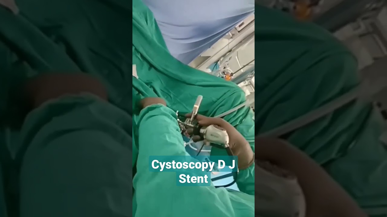 cystoscopy D J stent # short # viral video # 🔥🔥🔥