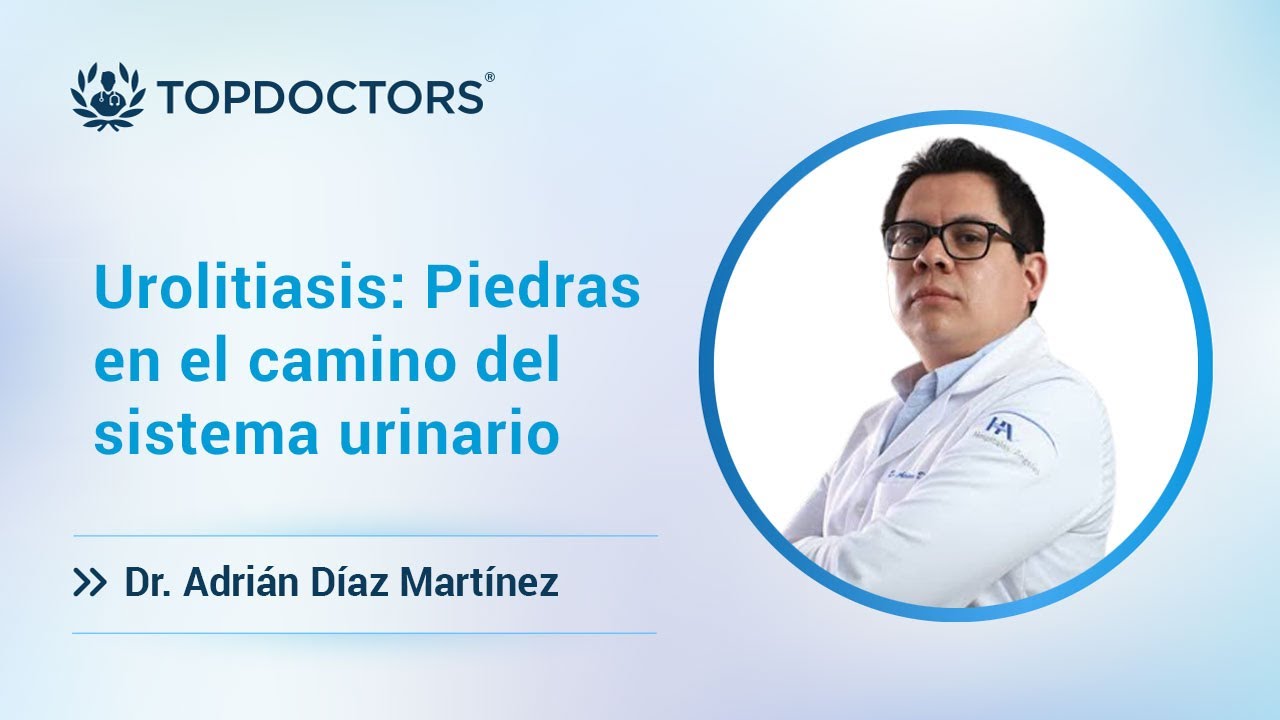 Urolitiasis: Piedras en el camino del sistema urinario